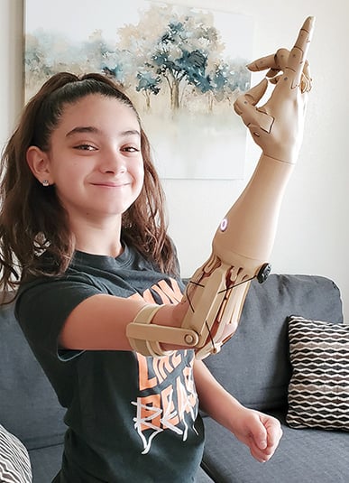 Unlimited Tomorrow Delivers Personalized Prosthetic Arms | SME Media